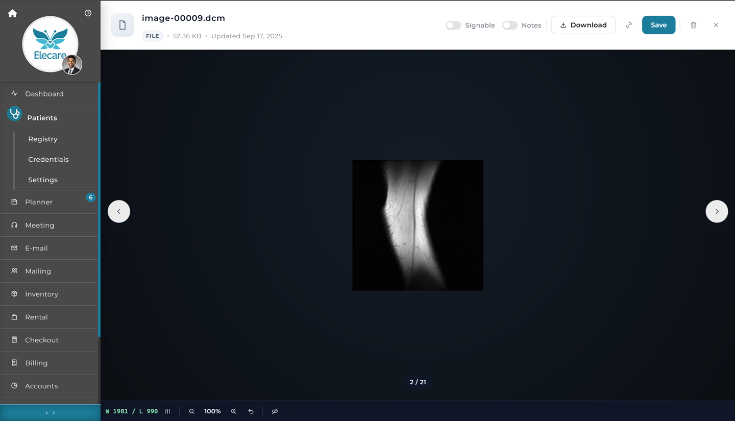 ElecareAI built-in DICOM imaging viewer